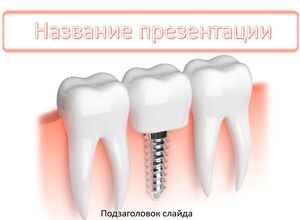 Зубной имплант
